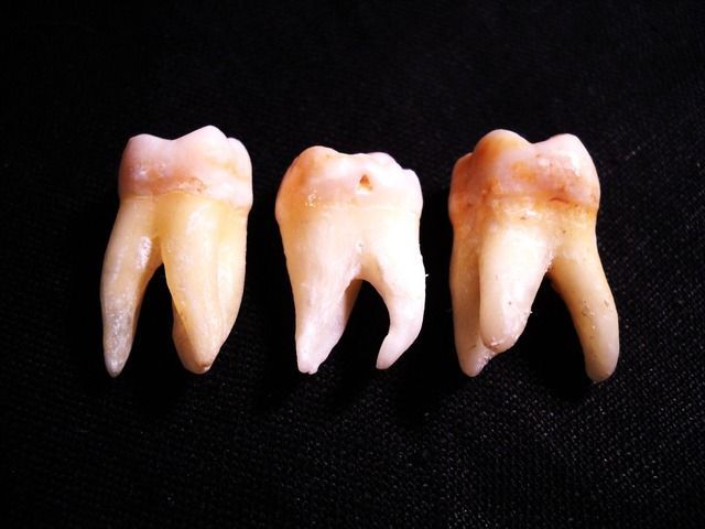 Teeth examples